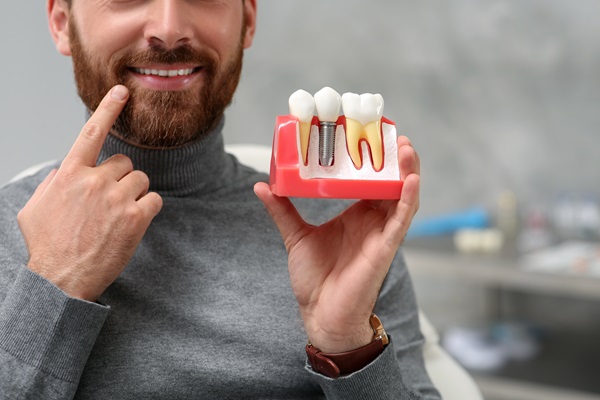 Reasons To Consider Getting Dental Implants From A Periodontist